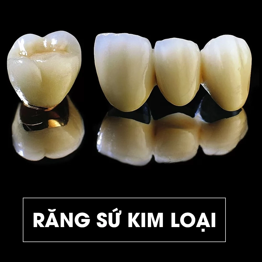 Lớp sườn kim loại sẫm màu bên trong cản ánh sáng tự nhiên đi qua